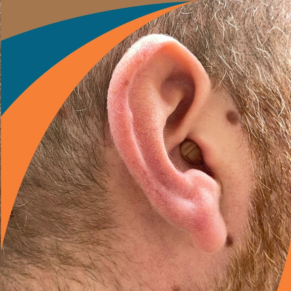 scelta-apparecchio-acustico Scelta apparecchio acustico